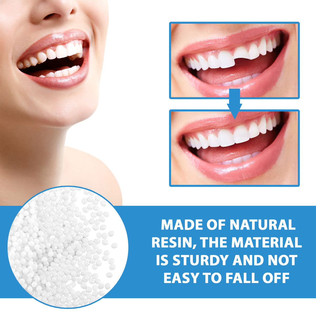 Professional Teeth Repair Kit - Instant Temporary Fix for Missing, Broken-30g
