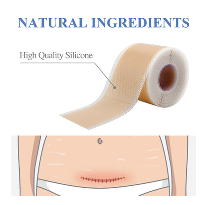 MediPatch Silicone Scar Sheets – Doctor-Tested, Invisible Healing for Surgery, Acne & Burn Scars