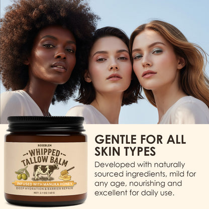 ROSEBLEM Whipped Tallow Balm - 100% Grass-Fed Beef Tallow and Honey Balm for Face & Body Moisturizer for Sensitive Skin 2.1oz