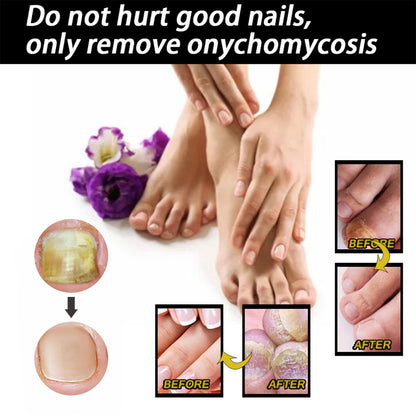 Arishine PENCIL BRIGHT: Doctor-Recommended Natural Nail Fungus Treatment with 5% Acetic Acid & Botanicals-30ml